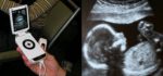 Un scanner à ultrason portable de petite taille.